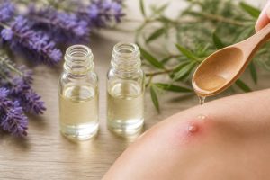 découvrez comment les huiles essentielles de lavande et d'arbre à thé peuvent soulager et soigner naturellement les furoncles grâce à leurs propriétés antibactériennes et apaisantes.